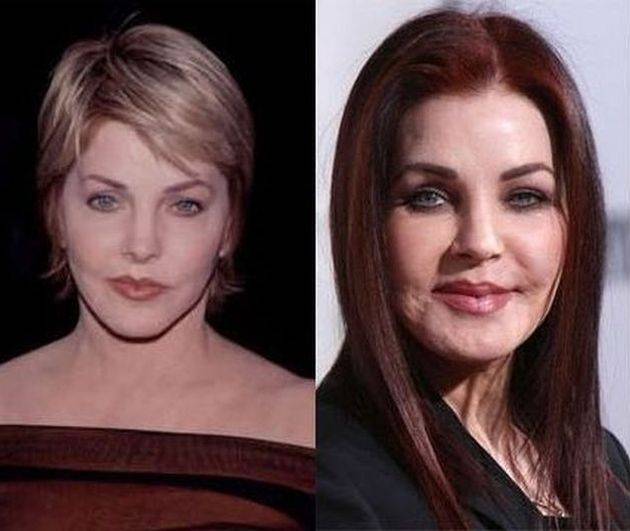Priscilla-Presley-Before-And-After-Plastic-Surgery.jpg