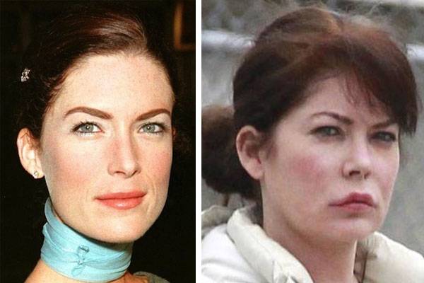 Lara-Flynn-Boyle-Plastic-Surgery-Gone-Wrong-Before-And-After-Photos.jpg