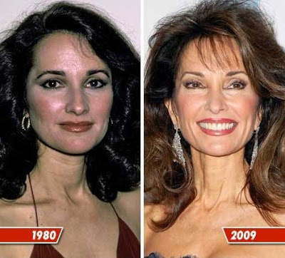 susan-lucci-plastic-surgery-before-and-after.jpg
