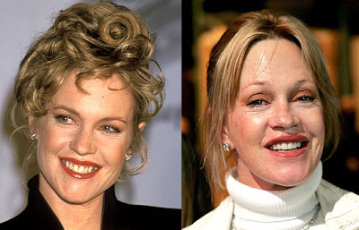 Melanie-Griffith-Before-And-After.jpg