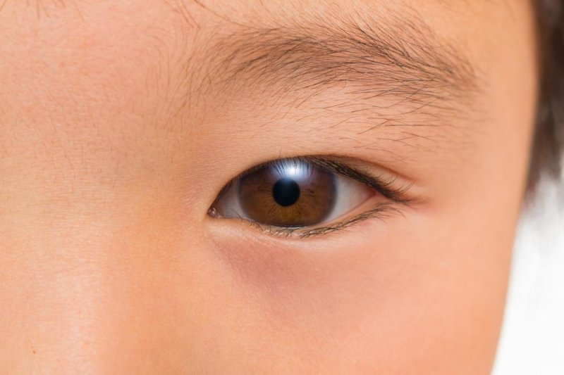 Simple-eye-test-may-detect-autism-in-children-sooner-researchers-say.jpg