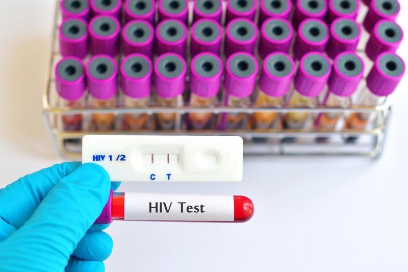 Teens-not-tested-for-HIV-as-often-as-recommended.jpg