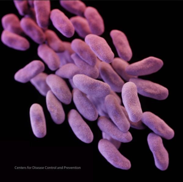 Medical-device-maker-recalls-scopes-linked-to-superbug-outbreak.jpg