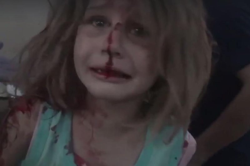 Images-capture-young-girl-calling-for-father-at-hospital-after-airstrike.jpg