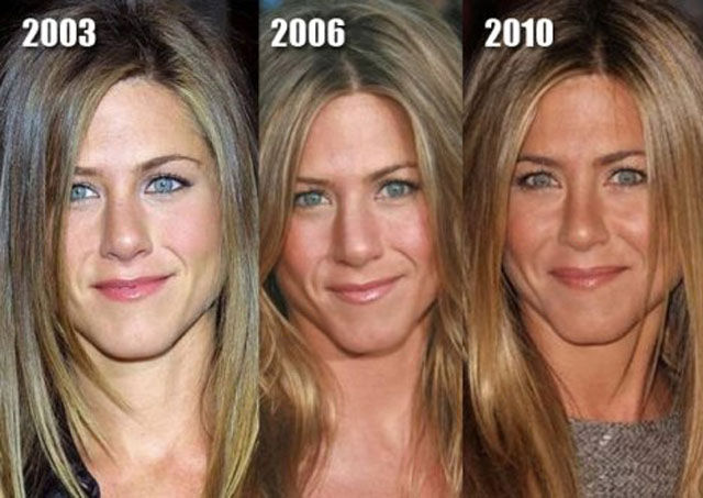 celebs_with_plastic_surgery_640_16.jpg