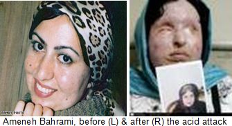 Ameneh-Bahrami-Iran-acid-attack-victim.jpg