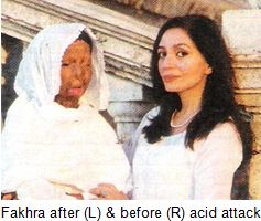 Fakhra-acid-attack-victim-pakistan.jpg