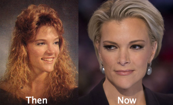 Megyn-Kelly-plastic-surgery-before-and-after.jpg