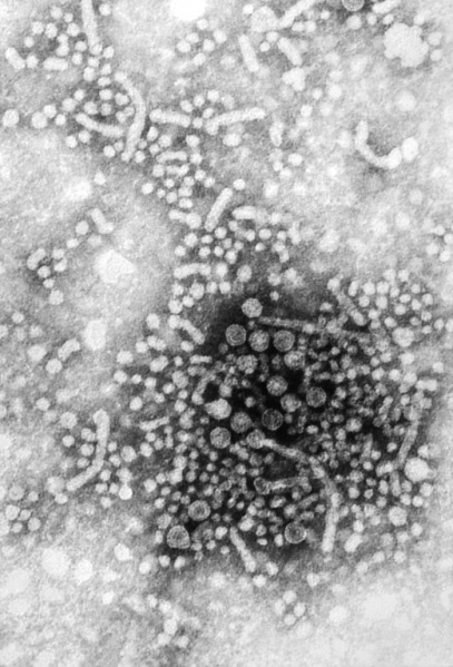 407px-Hepatitis_B_virus.jpg