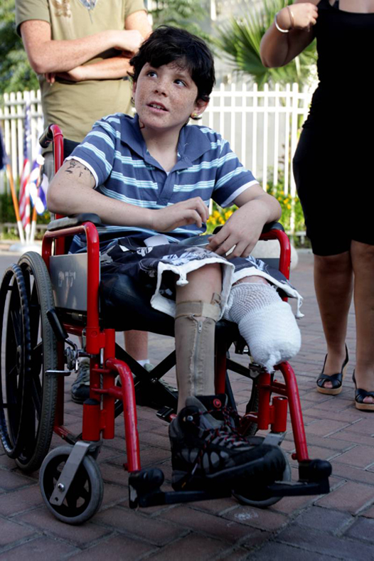 9-years_old_Israeli_boy_Osher_Twito_copes_with_lost_of_his_leg_after_Qassam_exploded_next_to_him_in_Sderot_Israel.jpg