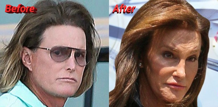 Bruce-Jenner-before-and-after-sex-change.jpg
