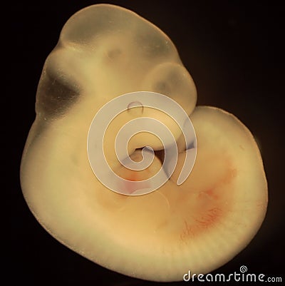 mouse-embryo-day-11-of-development-thumb744143.jpg