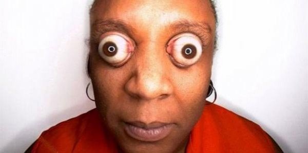 crazy-eyes-woman_big2777.jpg