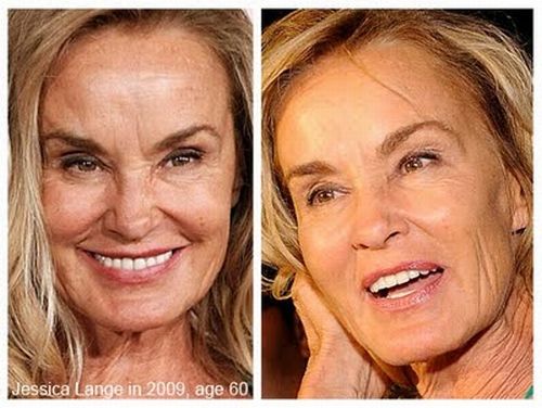 Jessica-Lange-plastic-surgery-before-and-after.jpg
