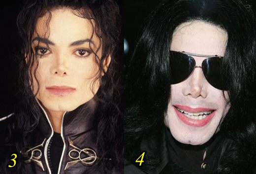 Michael-Jackson-Plastic-Surgery-Gone-Wrong-Before-and-After.jpg