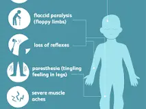 Image result for How is polio spread from person to person?