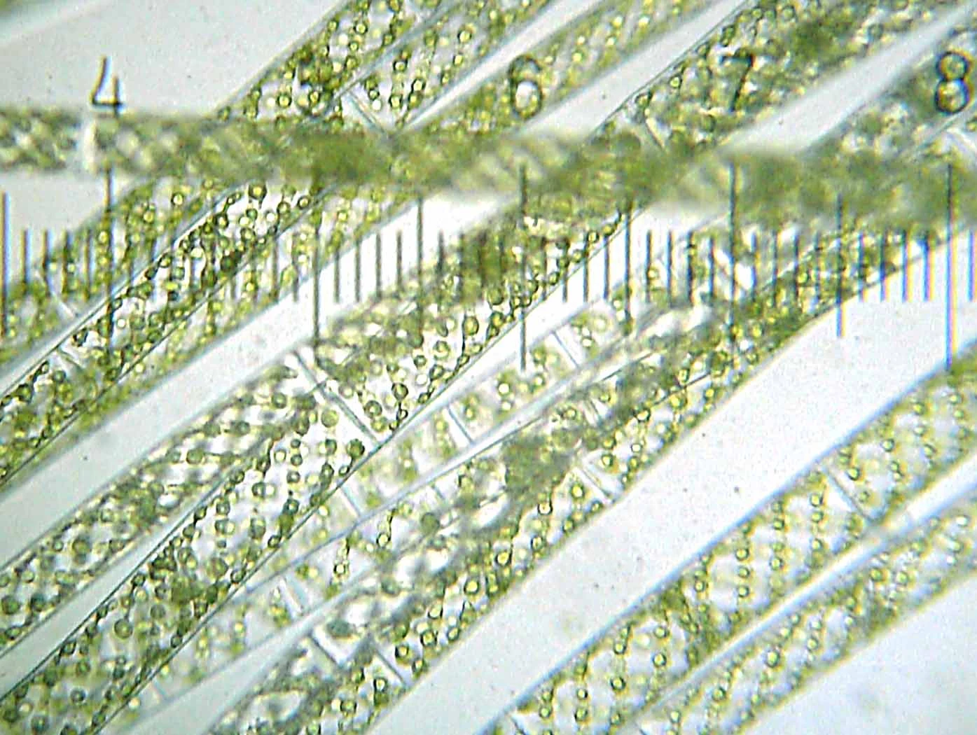 20090523_213732_Spirogyra.webp