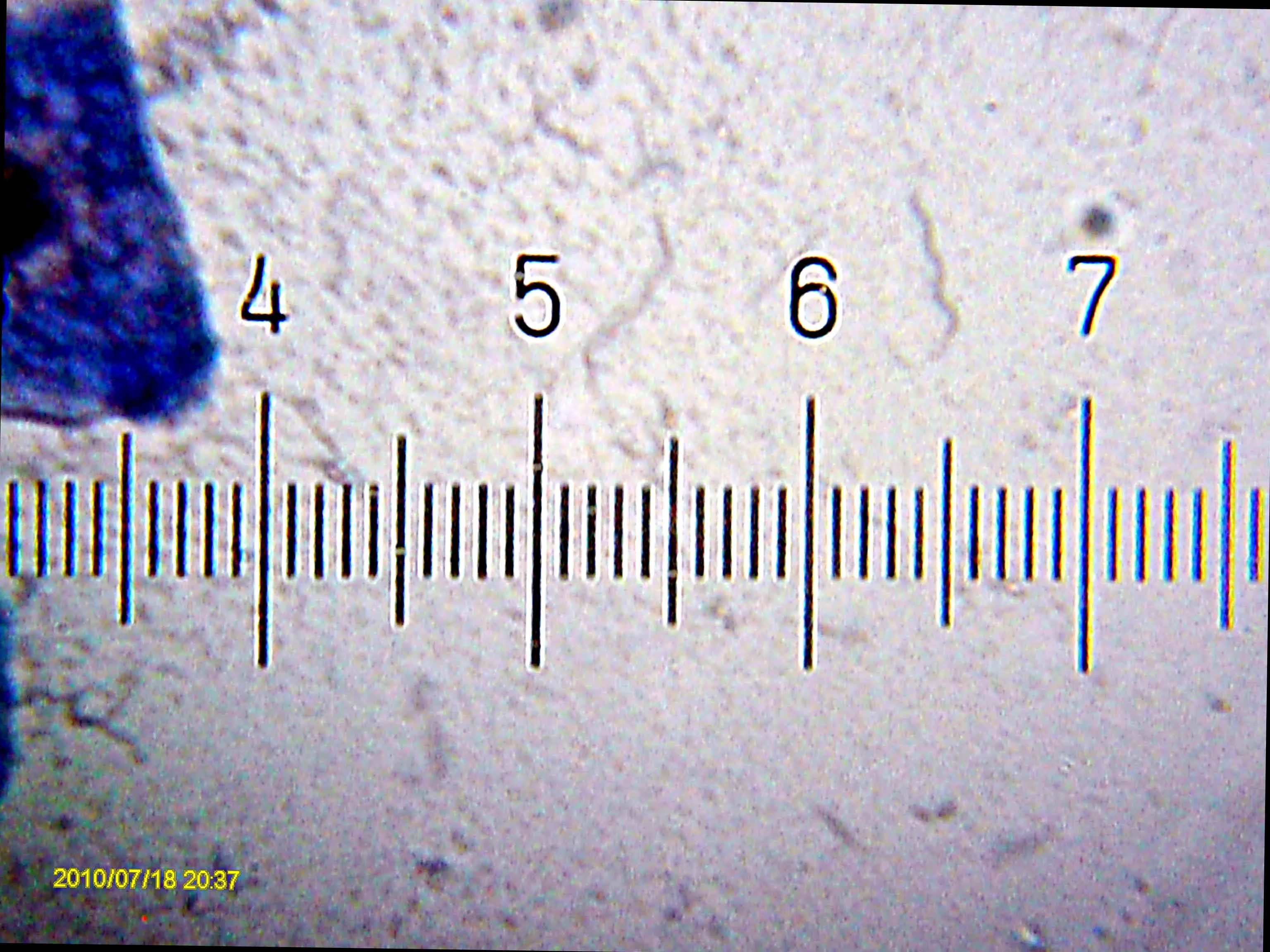 20100718_203745_CatSpit_Spirochaetes.webp