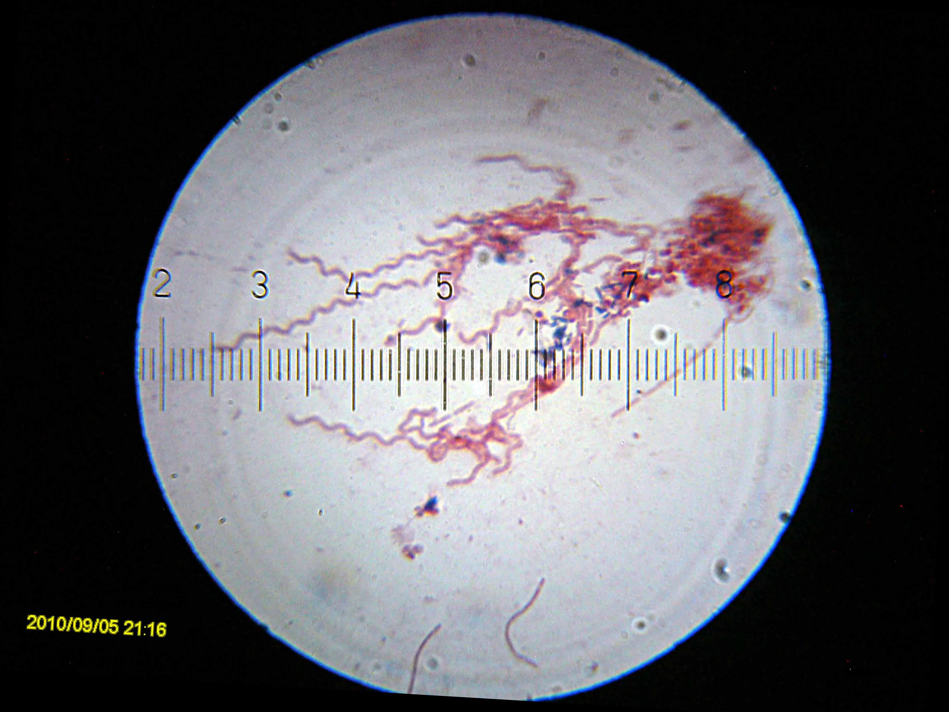 20100905_211652_Spirochetes.webp