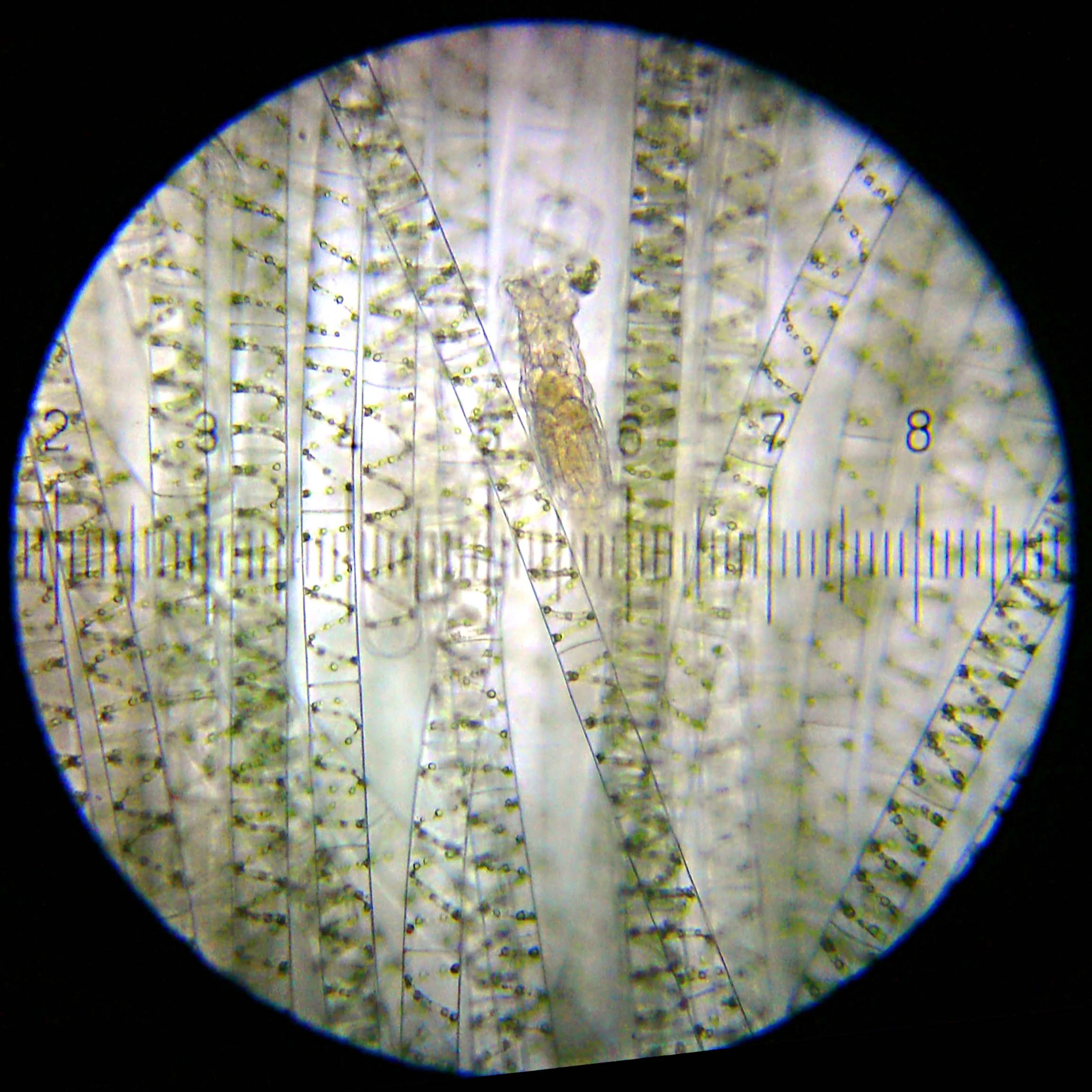 20140712_164147_SpirogyraAndRotifer_sq.webp