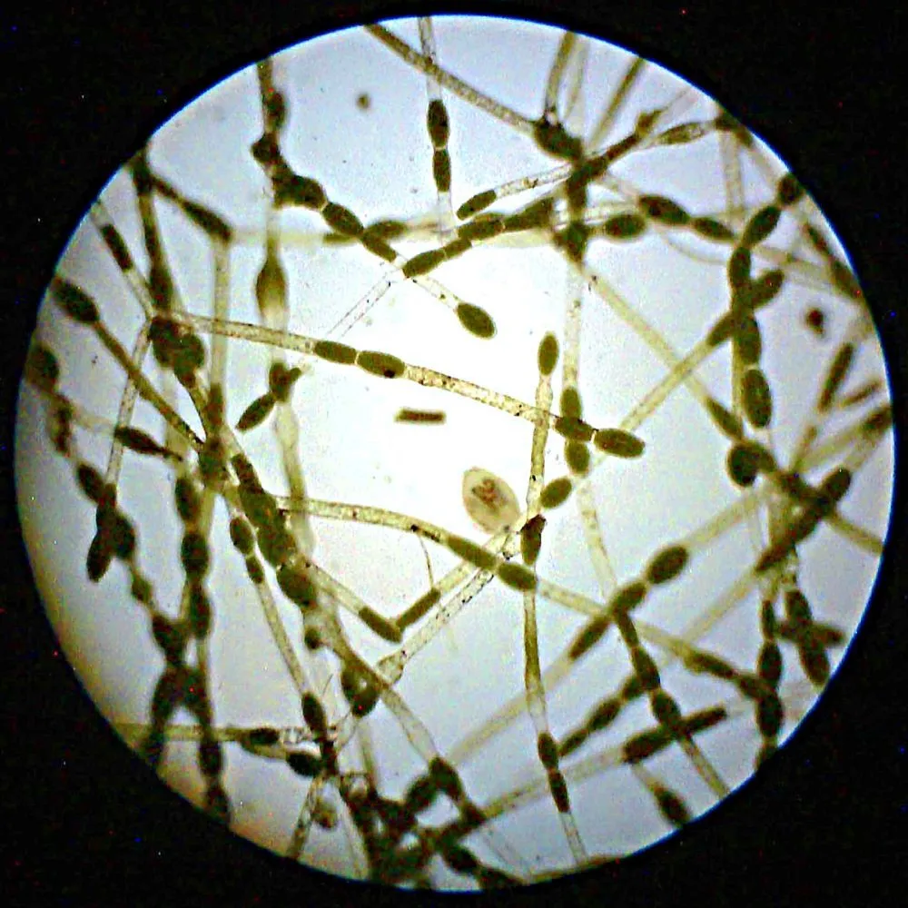 20140731_202827_Algae_1Ksq.webp