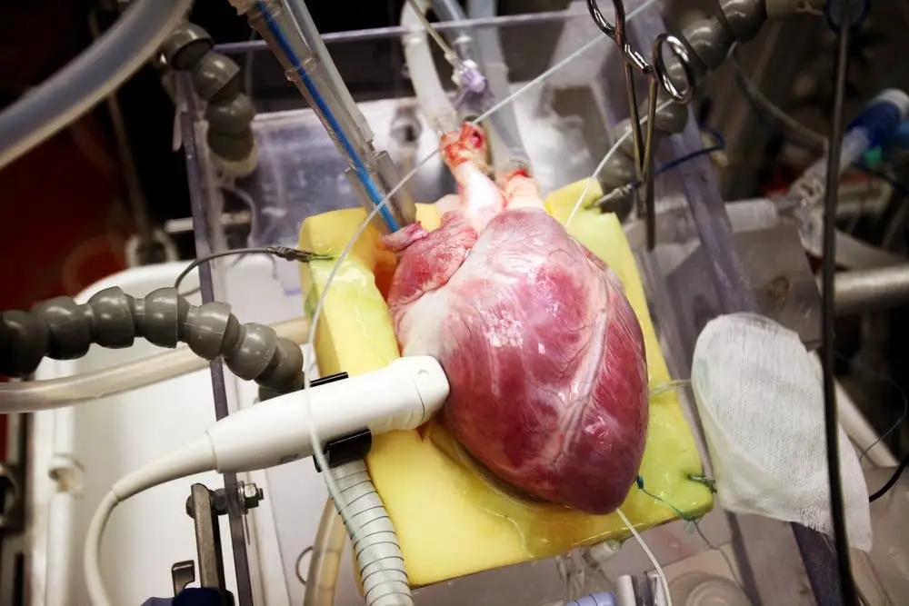2e385f-20120125-20120105heart6.webp