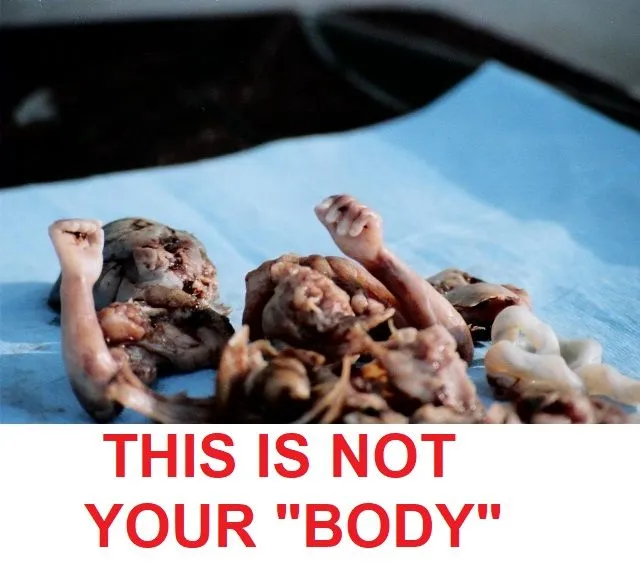 ```6 month old baby aborted.webp