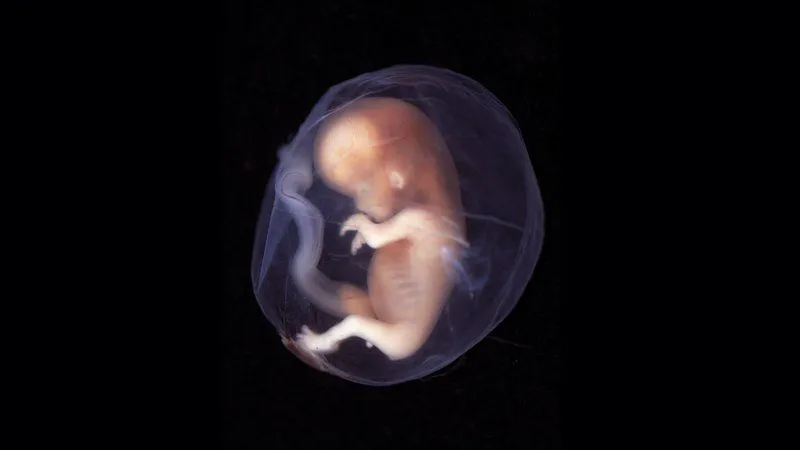 9-10-week-human-embryo.width-800.jpg