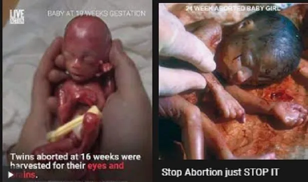 aborted humans.webp