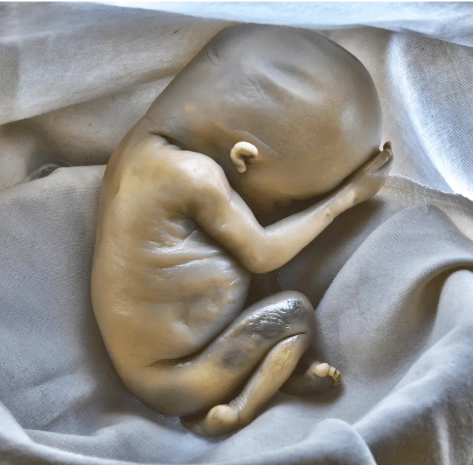 abortedbaby copy 2.webp