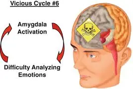 amygdala.webp