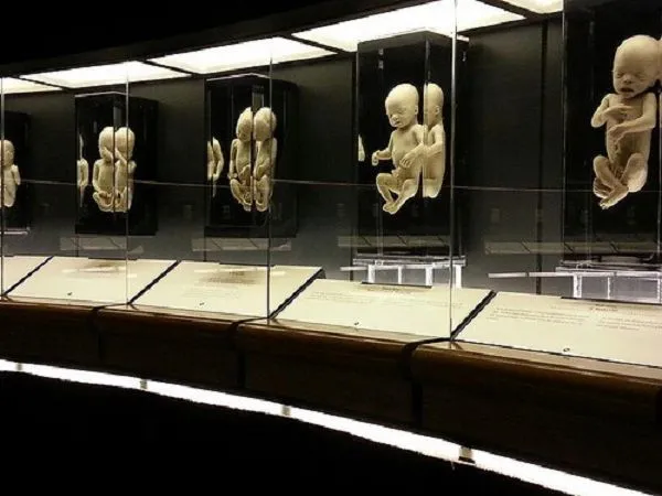 bodyworlds.webp