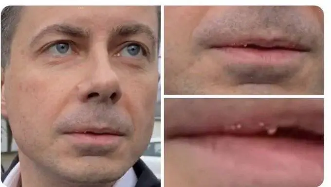 buttplub money pox.webp