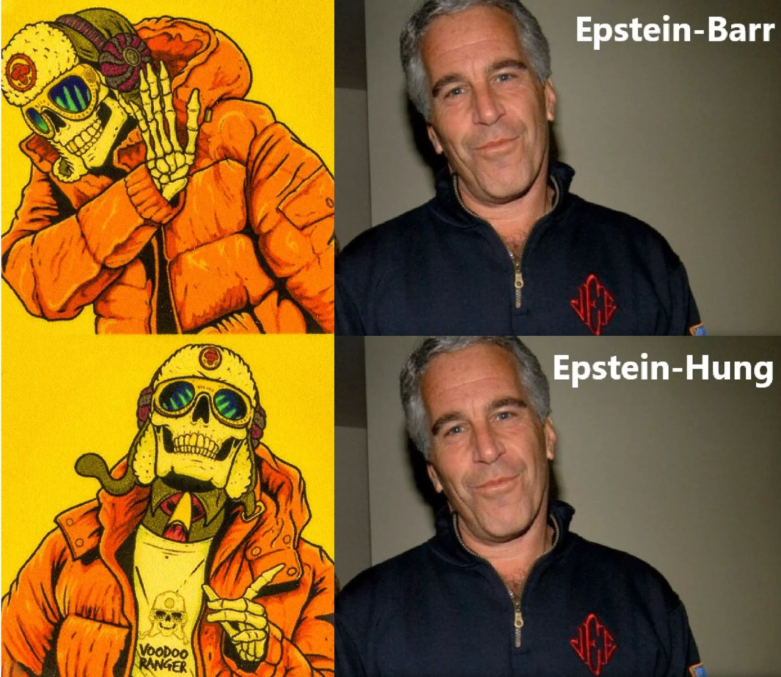 epstein barr.webp