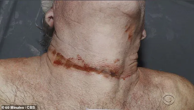epstein-neck.webp