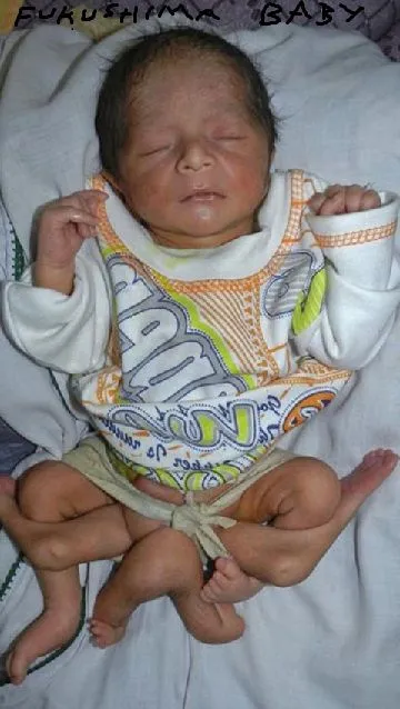fukushima_baby_deformities_mutations (1).webp