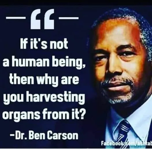 Harvesting organs from aborted babies.jpg