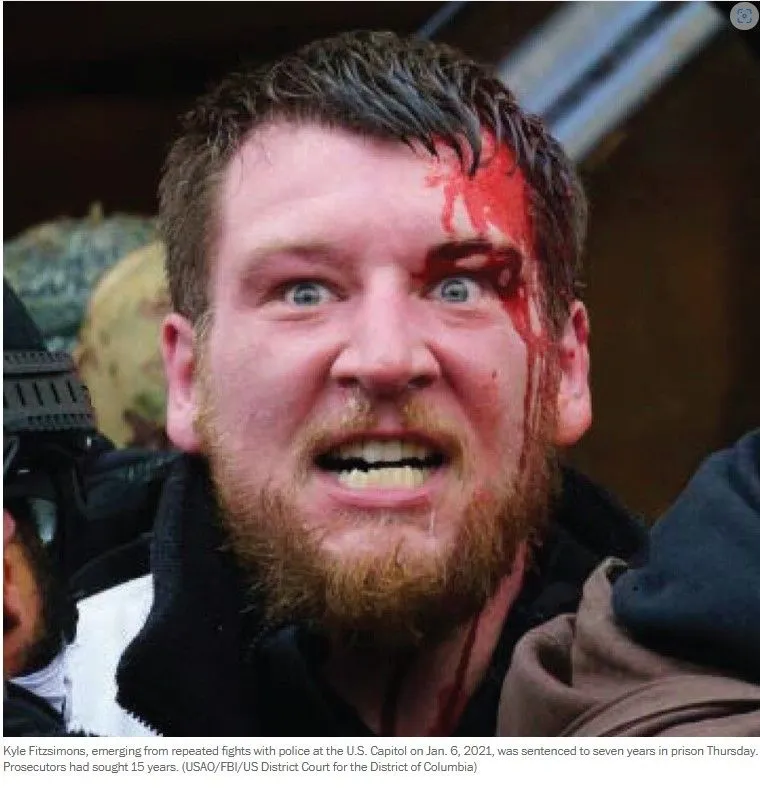 Jan 6 guilty bloodied face.webp