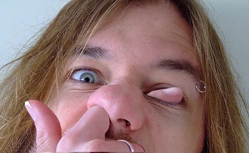 Man-Picking-his-Nose-and-Eye--59743.webp
