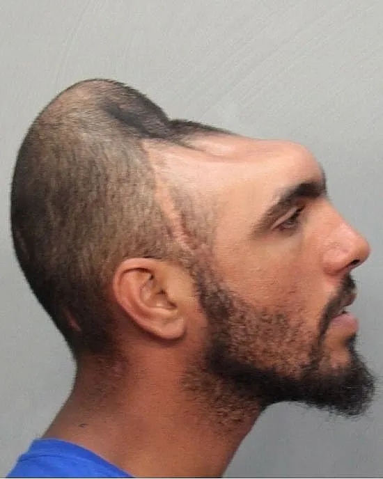 Man-with-Half-head-3.webp