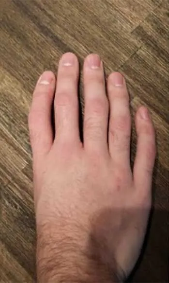 no thumb.webp
