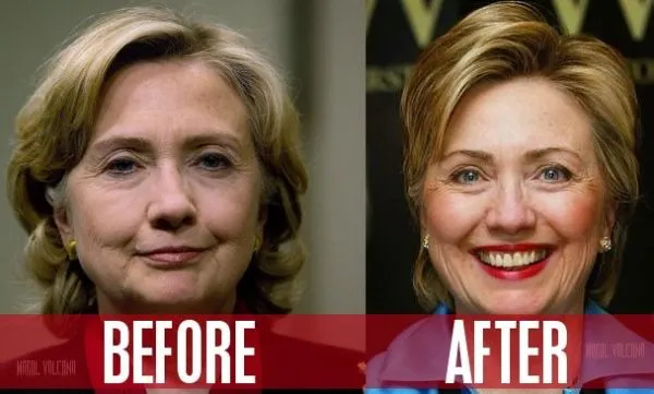 photo-hillary-clinton-before-and-after-plastic-surgery.jpg