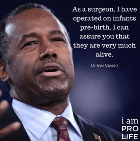 Prebirth infants are alive Ben Carson.webp