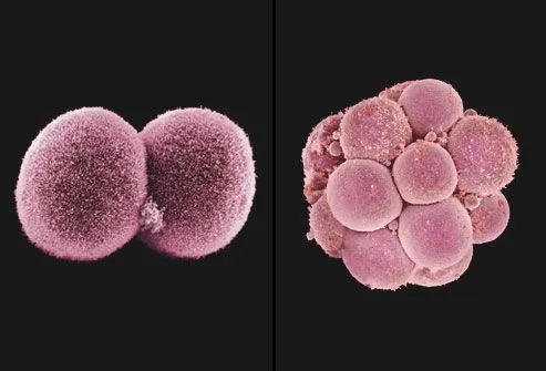 PRinc_rm_composite_SEM_of_cell_division.webp