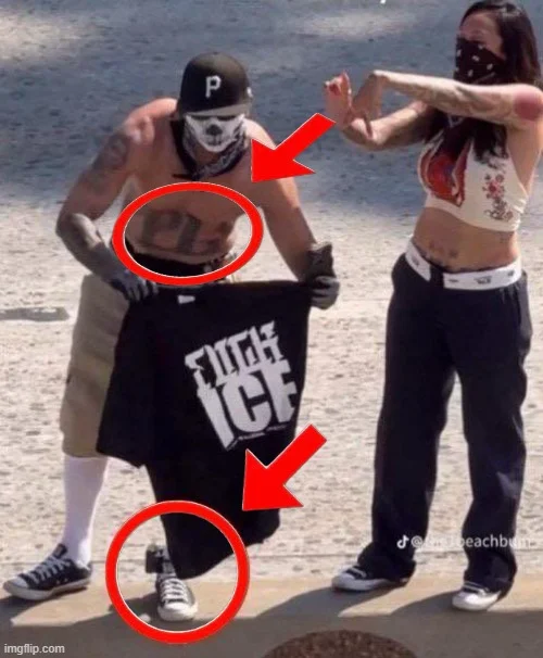 protestor w ankle.webp