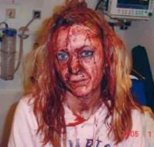Rape_victim_in_Sweden.webp