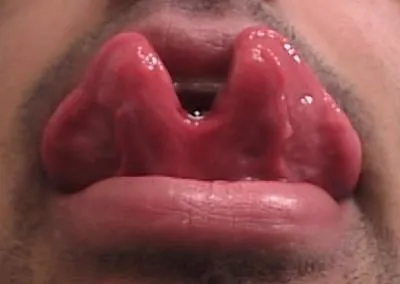 tongue-split-tm.webp