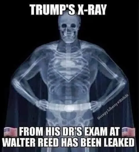 trumps xray.webp