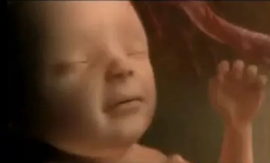 ultrasound4d18b.webp