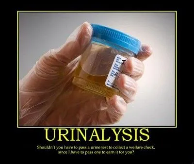 URINALYSIS-e1328054224371.webp